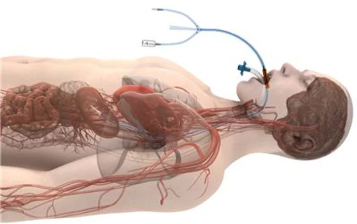 Attune Medical’s ensoETM™ Granted FDA De Novo Marketing Authorization to Reduce the Likelihood of Ablation-related Esophageal Injury Resulting from Radiofrequency Cardiac Ablation Procedures