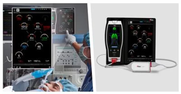 Masimo Receives EU MDR CE Mark for LiDCO® Module for Hemodynamic Monitoring