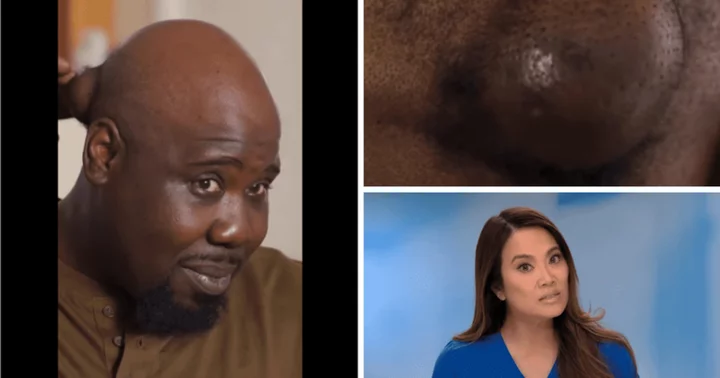 Where is Jeffrey now? 'Dr Pimple Popper' Season 9 patient seeks Dr Lee's help to remove his lemon-sized lump