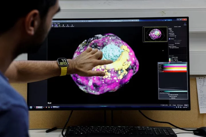 Israeli scientists create model of human embryo without eggs or sperm