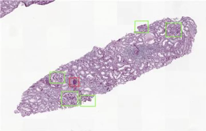 Aiosyn Introduces Kidney AI Platform to Revolutionize Renal Disease Research