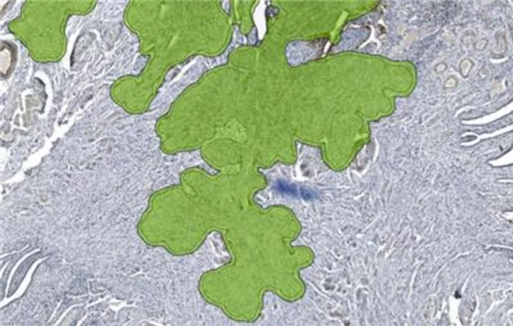 Aiosyn Expands its AI-Powered Quality Control Solution for Digital Pathology Slides to Support Immunohistochemistry (IHC) Staining