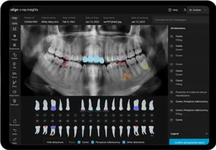 Align Technology Introduces New Software Innovations Designed to Accelerate Digital Practice Transformation